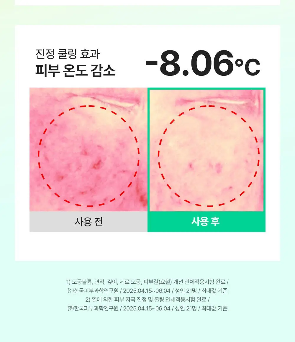 [7월올영픽/곰돌이푸콜라보] 성분에디터 그린토마토 NMN 포어 리프팅 앰플 40ml 더블 기획 (+히퍼 랜덤 1종) 상세페이지 27